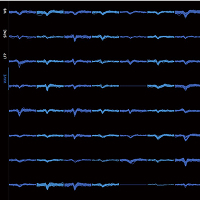 High Channel Capacity