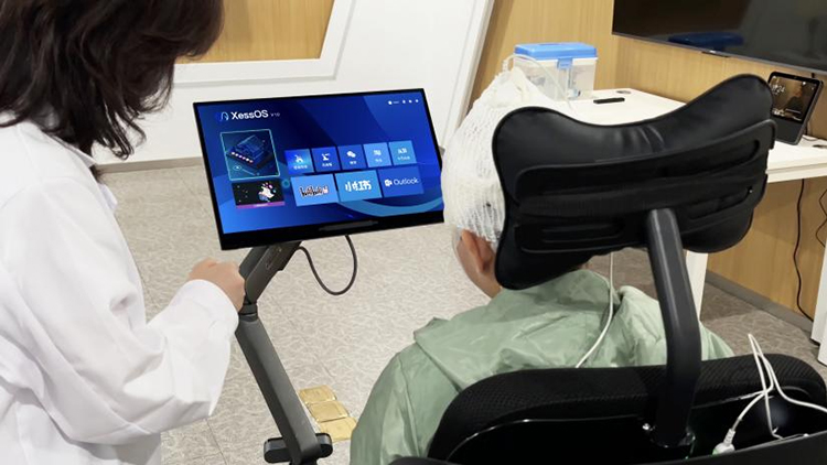 Major Breakthrough in Clinical Trials of High-Throughput Implantable Flexible BCI by Shanghai Team — “Mind-Controlled” Smart Devices and “Thought Dialogue” Become Reality