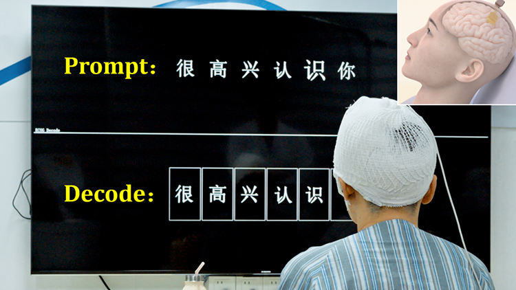 World’s First! NeuroXess’s Real-Time Chinese Language Decoding Breakthrough Published in Science Advances, Gaining Widespread Global Attention