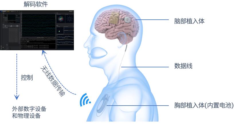三全功能